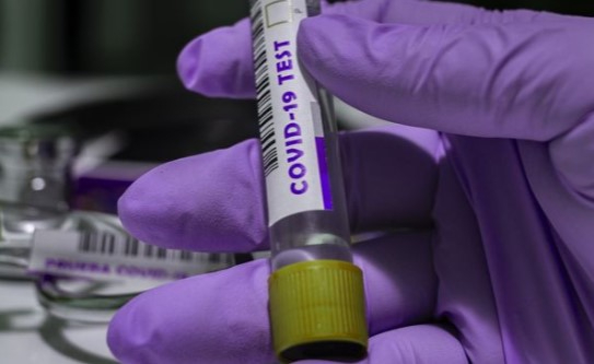 Үндістанда ондаған мың адам коронавирустың жаңа бір түрін жұқтырған